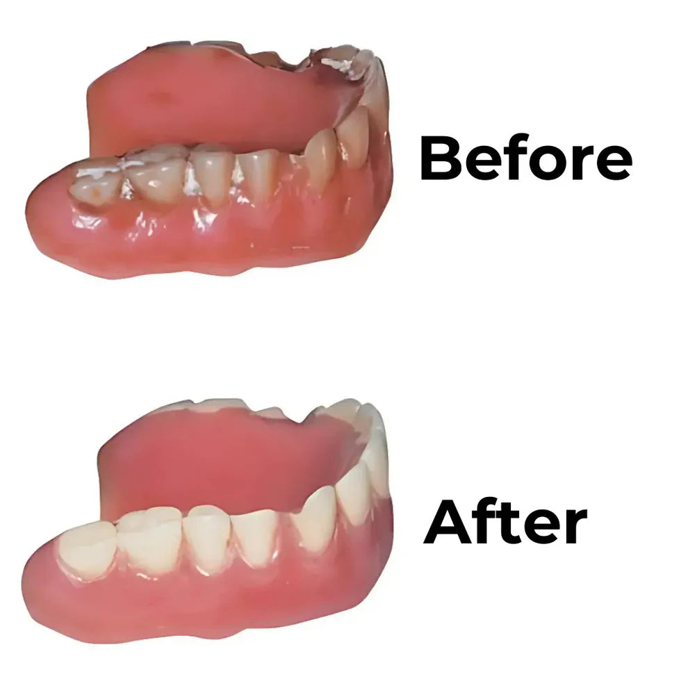 PureDome™ Clinic-Grade Denture Cleaner