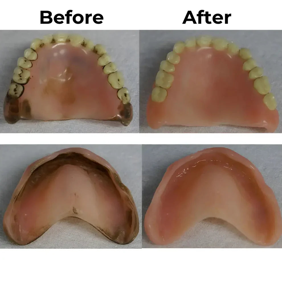 PureDome™ Clinic-Grade Denture Cleaner